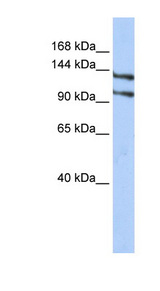 RBM5 antibody western blot of HepG2 cell lysate.
