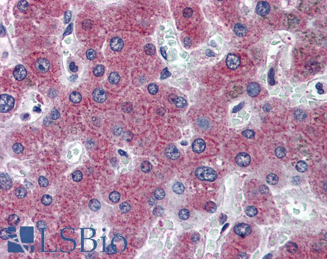 Anti-RBP4 antibody IHC of human liver. Immunohistochemistry of formalin-fixed, paraffin-embedded tissue after heat-induced antigen retrieval. Antibody LS-B6143 concentration 5 ug/ml.