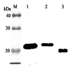 Western blot analysis using anti-RBP4 (rat), pAb at 1:2000 dilution. 1: Rat RBP4 (His-tagged). 2: Rat RBP4 (FLAG-tagged). 2: Rat serum (GK/SIc) (1 ul).
