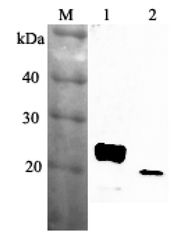 Western blot analysis using anti-RBP4 (mouse), pAb at 1:2000 dilution. 1: Mouse RBP4 (His-tagged). 2: Mouse serum (ob/ob) (2 ul).