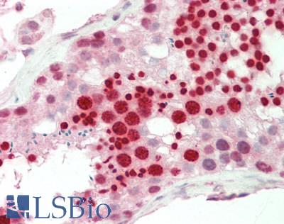 Human Testis: Formalin-Fixed, Paraffin-Embedded (FFPE)