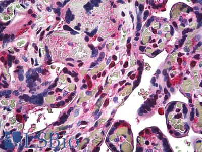 Anti-RBX1 antibody IHC of human placenta. Immunohistochemistry of formalin-fixed, paraffin-embedded tissue after heat-induced antigen retrieval. Antibody LS-B5298 dilution 1:50.