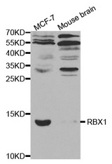 Western blot analysis of extracts of various cell lines, using RBX1 antibody.