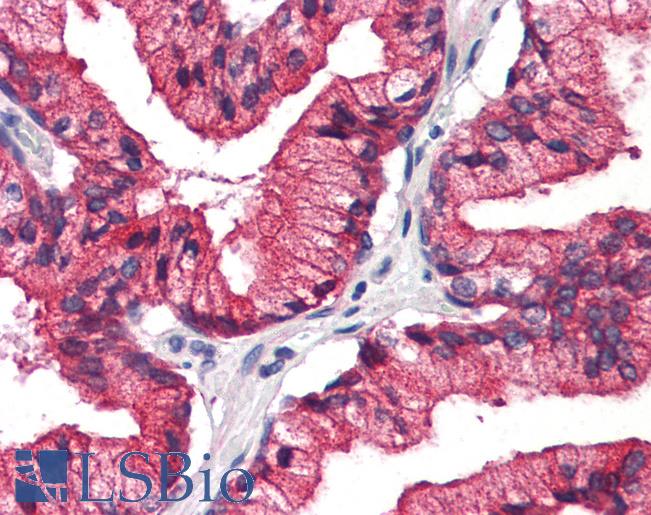 Human, Prostate: Formalin-Fixed Paraffin-Embedded (FFPE)