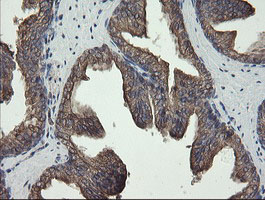 IHC of paraffin-embedded Human prostate tissue using anti-REEP5 mouse monoclonal antibody.