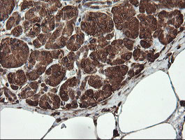 IHC of paraffin-embedded Human pancreas tissue using anti-REEP5 mouse monoclonal antibody.