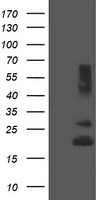 HEK293T cells were transfected with the pCMV6-ENTRY control (Left lane) or pCMV6-ENTRY REEP5 (Right lane) cDNA for 48 hrs and lysed. Equivalent amounts of cell lysates (5 ug per lane) were separated by SDS-PAGE and immunoblotted with anti-REEP5.