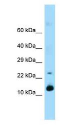 REG1A / REG antibody Western Blot of Mouse Pancreas.