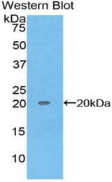 Western blot of recombinant REG1A / REG.