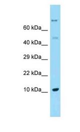 REG1A / REG antibody Western Blot of Fetal Liver. Antibody dilution: 1 ug/ml.