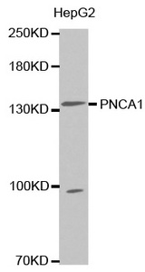 Western blot analysis of extracts of HepG2 cell line, using PNCA1 antibody.