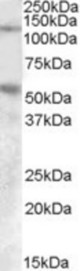 PALLD antibody (0.1 ug/ml) staining of Human Umbilical Cord lysate (35 ug protein/ml in RIPA buffer) with (B) and without (A) blocking with the immunizing peptide. Primary incubation was 1 hour. Detected by chemiluminescence.