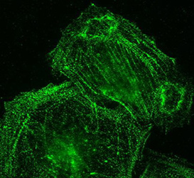 Palladin Antibody (1E6) - Immunofluorescence on a7r5 cells.