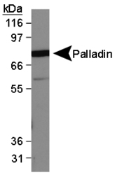 Palladin Antibody (1E6) - Western Blot on MDA-MB-231 lysate.