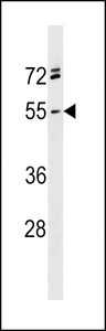 RGMA Antibody western blot of NCI-H460 cell line lysates (35 ug/lane). The RGMA antibody detected the RGMA protein (arrow).
