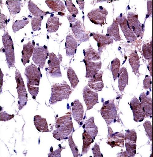 TrkA-pY791 Antibody immunohistochemistry of formalin-fixed and paraffin-embedded human skeletal muscle followed by peroxidase-conjugated secondary antibody and DAB staining.