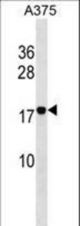 RHOF Antibody western blot of A375 cell line lysates (35 ug/lane). The RHOF antibody detected the RHOF protein (arrow).