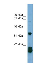 RHOF antibody LS-C112026 Western blot of 293T cell lysate.