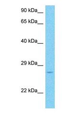 Western blot of RHOF Antibody with human Lymph Node Tumor lysate.
