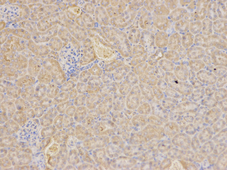 Immunohistochemistry of paraffin-embedded mouse kidney using RIPK2 antibody at dilution of 1:100 (200x lens).