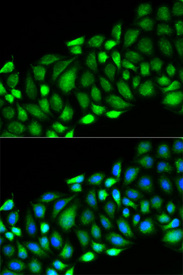 Immunofluorescence analysis of HeLa cell using RIPK2 antibody. Blue: DAPI for nuclear staining.
