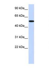 RIPK2 / RIP2 antibody LS-C112286 Western blot of HepG2 Cell lysate. Antibody concentration 1 ug/ml.