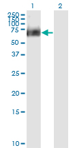 Western blot of RIPK2 expression in transfected 293T cell line by RIPK2 monoclonal antibody (M02), clone 6F7.