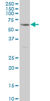 RIPK2 monoclonal antibody (M02), clone 6F7 Western blot of RIPK2 expression in HeLa.