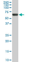 RIPK2 monoclonal antibody (M03), clone 3D9. Western blot of RIPK2 expression in Raw 264.7.