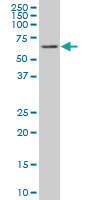 RIPK2 monoclonal antibody (M03), clone 3D9 Western blot of RIPK2 expression in HeLa.