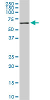 RIPK2 monoclonal antibody (M03), clone 3D9. Western blot of RIPK2 expression in PC-12.