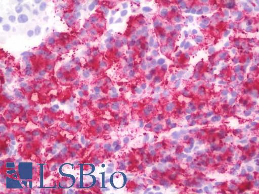 IHC with RIPK2 antibody on frozen human pancreas.