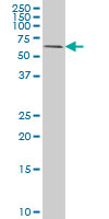 RIPK2 monoclonal antibody, clone 7F5 Western blot of RIP2 expression in HeLa.
