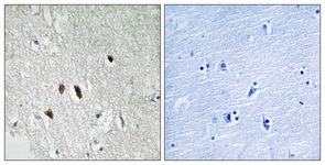 IHC of paraffin-embedded human brain tissue, using RIPK2 Antibody. The sample on the right was incubated with synthetic peptide.