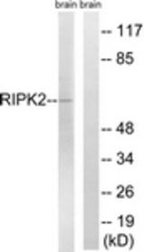 Western blot of extracts from rat brain cells, using RIPK2 Antibody. The lane on the right was incubated with synthetic peptide.
