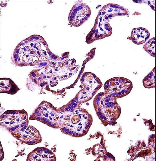 RIPK2 Antibody immunohistochemistry of formalin-fixed and paraffin-embedded human placenta tissue followed by peroxidase-conjugated secondary antibody and DAB staining.