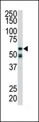 Western blot of anti-RIPK2 antibody in mouse cerebellum tissue lysate. RIPK2 (arrow) was detected using purified antibody. Secondary HRP-anti-rabbit was used for signal visualization with chemiluminescence.