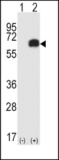 Western blot of RIPK2 (arrow) using rabbit polyclonal RIPK2 Antibody (D474). 293 cell lysates (2 ug/lane) either nontransfected (Lane 1) or transiently transfected (Lane 2) with the RIPK2 gene.