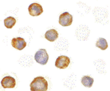Immunocytochemistry of RICK in K562 cells with RICK antibody at 5 ug/ml.