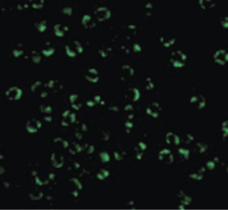 Immunofluorescence of RICK in K562 cells with RICK antibody at 20 ug/ml.