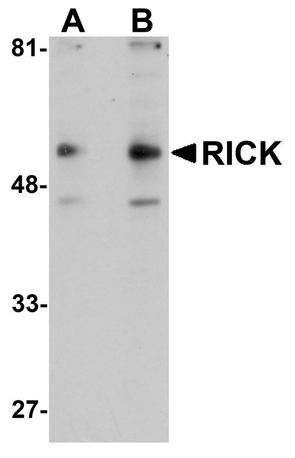 Western blot analysis of RICK in A431 cell lysate with RICK antibody at (A) 1 and (B) 2 ug/ml.