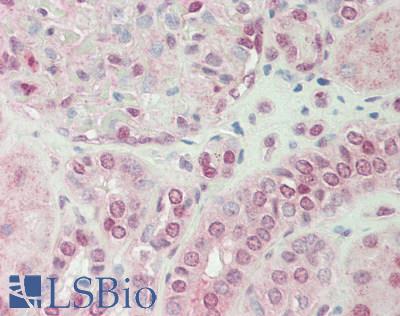 Human Kidney: Formalin-Fixed, Paraffin-Embedded (FFPE)