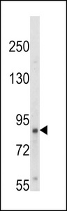 Western blot of hTrkA-pY791 in HepG2 cell line lysates (35 ug/lane). TRK (arrow) was detected using the purified antibody.