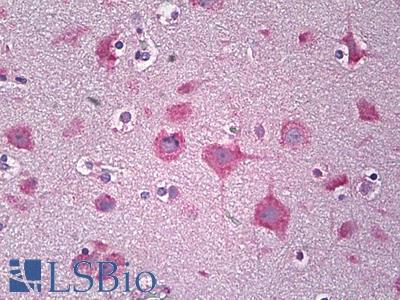 Anti-PARD3 antibody IHC of human brain, cortex neurons. Immunohistochemistry of formalin-fixed, paraffin-embedded tissue after heat-induced antigen retrieval. Antibody LS-B6786 concentration 10 ug/ml.