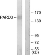 Western blot of extracts from COLO205 cells, using PARD3 Antibody. The lane on the right is treated with the synthesized peptide.