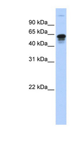 FAM82A1 antibody LS-C111139 Western blot of Transfected 293T cell lysate.