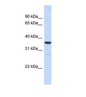 Western blot of Human HepG2. RMDN3 antibody dilution 1.0 ug/ml.