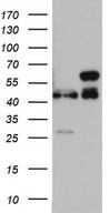 HEK293T cells were transfected with the pCMV6-ENTRY control (Left lane) or pCMV6-ENTRY RMND5A (Right lane) cDNA for 48 hrs and lysed. Equivalent amounts of cell lysates (5 ug per lane) were separated by SDS-PAGE and immunoblotted with anti-RMND5A.