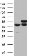 HEK293T cells were transfected with the pCMV6-ENTRY control (Left lane) or pCMV6-ENTRY RMND5A (Right lane) cDNA for 48 hrs and lysed. Equivalent amounts of cell lysates (5 ug per lane) were separated by SDS-PAGE and immunoblotted with anti-RMND5A.