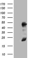 HEK293T cells were transfected with the pCMV6-ENTRY control (Left lane) or pCMV6-ENTRY RMND5A (Right lane) cDNA for 48 hrs and lysed. Equivalent amounts of cell lysates (5 ug per lane) were separated by SDS-PAGE and immunoblotted with anti-RMND5A.